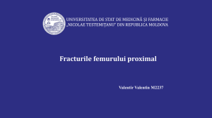 Fracturile femurului proximal: Diagnostic și Tratament